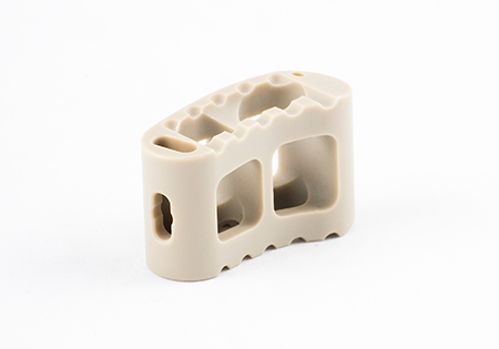 Spinal fusion part completed using GibbsCAM CNC software