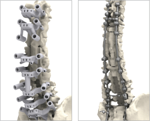 Anatomical Model Comparison